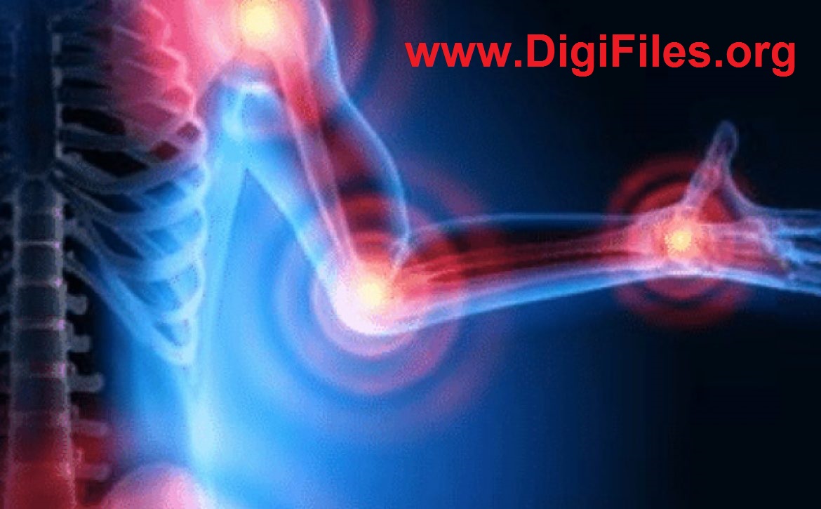 اختلالات اسكلتي عضلاني مرتبط با كار